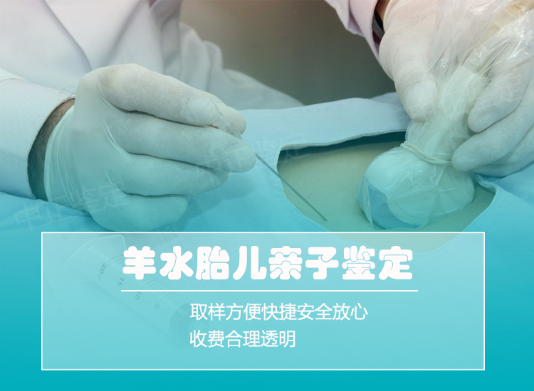 台州羊水孕期亲子鉴定